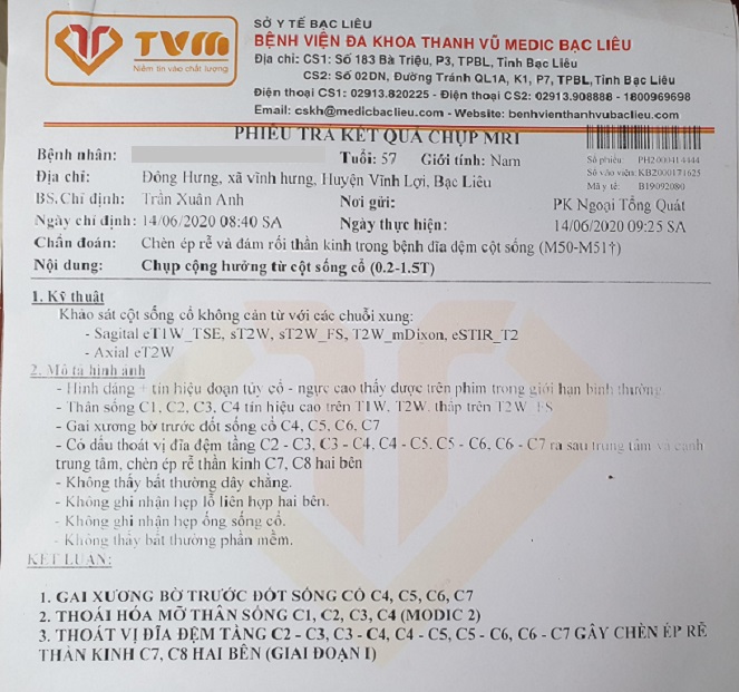 Chữa thoát vị đĩa đệm tại nhà